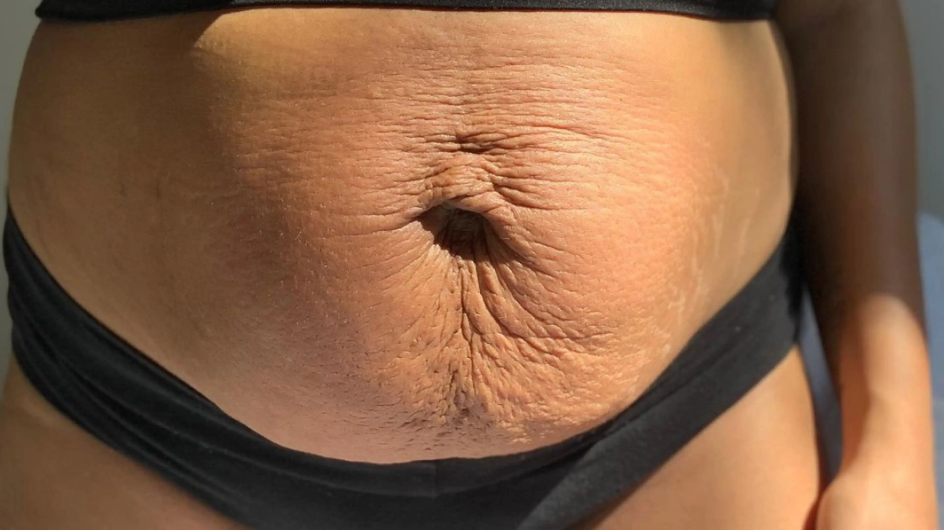 How Your Postpartum Body May Change and What to Do About It